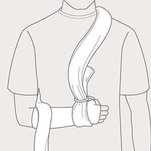 Step 3 of arm support with Collar'n'Cuff
